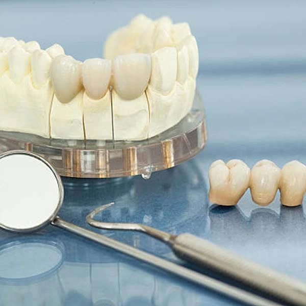 Soins Dentaires Compréhensifs - clinique dentaire tetouan maroc