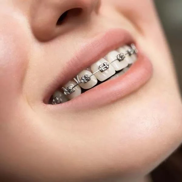 Soins Dentaires Compréhensifs - clinique dentaire tetouan maroc