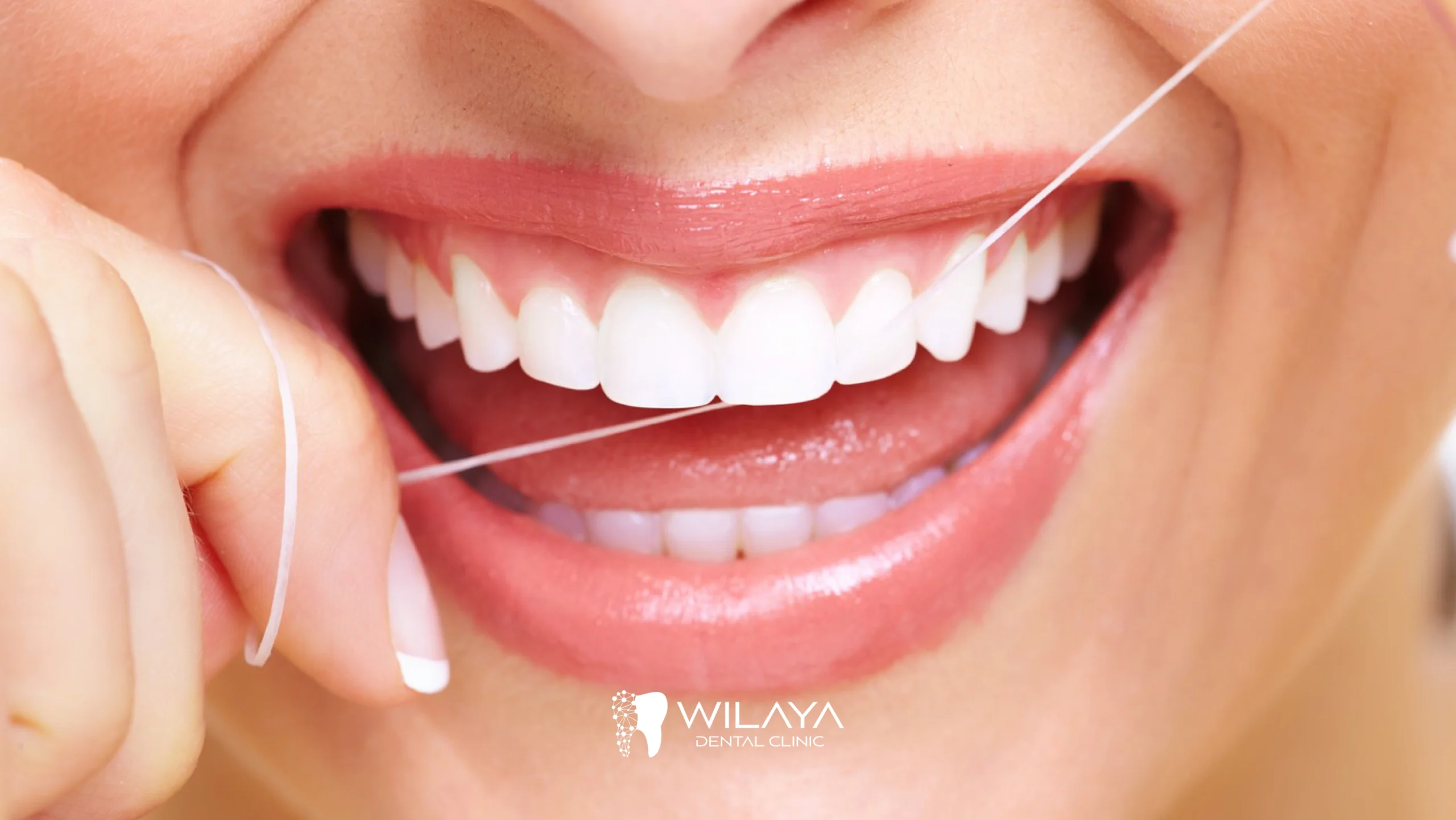 Importance du Fil Dentaire pour une Hygiène Bucco-dentaire Optimale-wilaya-dental-clinic-tetouan-maroc-01