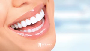 blanchiment-dentaire-wilaya-dental-clinic-tetouan-maroc