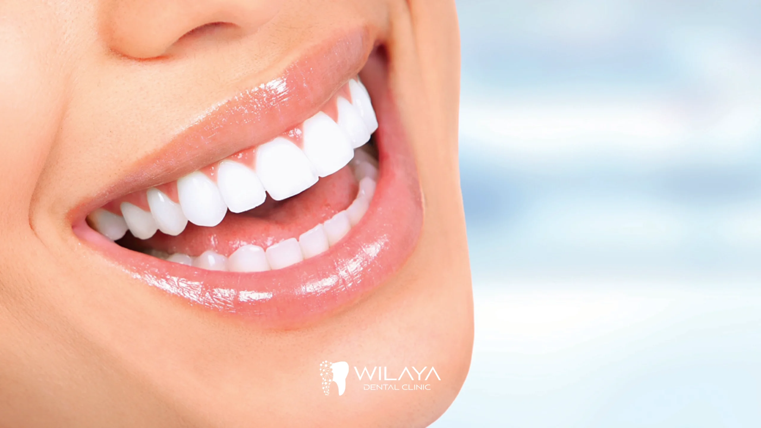 blanchiment-dentaire-wilaya-dental-clinic-tetouan-maroc